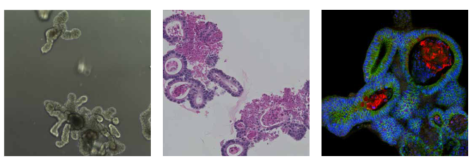 Pertumbuhan dan karakterisasi organoid usus dalam Corning Matrigel Matrix