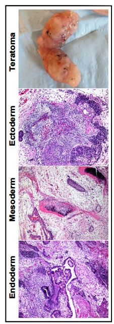 Teratoma dan tiga lapisan germinal dari hiPSC yang dipelihara dengan Matrigel hESC-qualified Matrix
