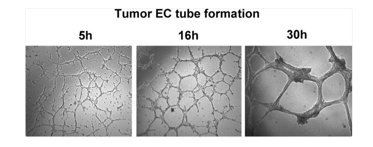 Pembentukan struktur menyerupai pembuluh darah (tube formation) oleh sel endotel tumor pada model kultur berbasis Matrigel setelah 5, 16, dan 30 jam